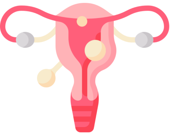 Fibroid & Adenomyosis