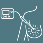 Ablation
