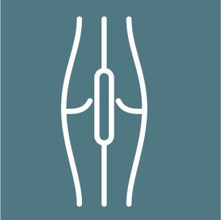 Angioplasty