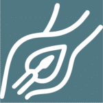 Atherectomy