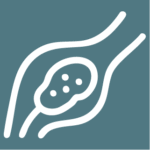 Clot Dissolving Treatment