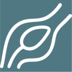 Peripheral Angioplasty